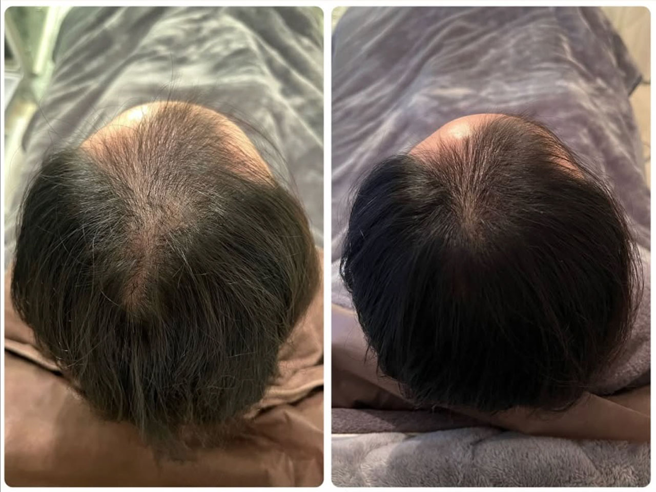 メンズ症例写真4